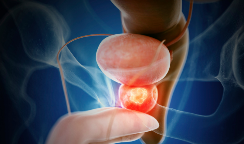 Traitement des symptômes d'une hypertrophie bénigne de la prostate