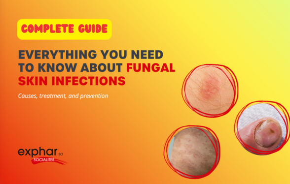 Fungal Infection - exphar RCI